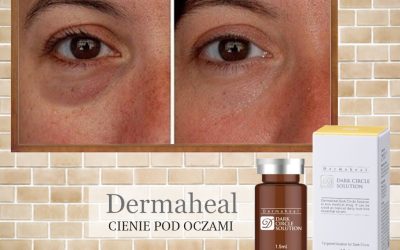 Dermaheal Dark Circle Solution