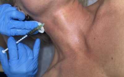 Naturalne zabiegi – skuteczna droga do pięknej, zdrowej skóry