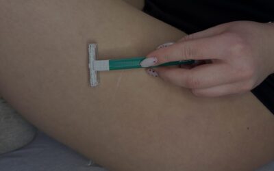 Bezbłędna depilacja laserowa – najlepsza technika w Bydgoszczy